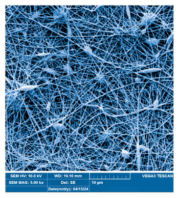 NanoVent NanoMembrane